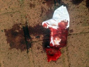 imagem de roupa ensanguentada em frente ao oliveiras place setor bueno goiania foto de carlos willian