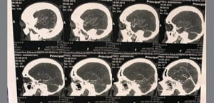 exames de cunha reproducao