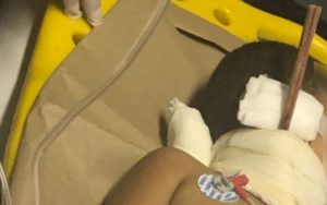 menino ferido madeira