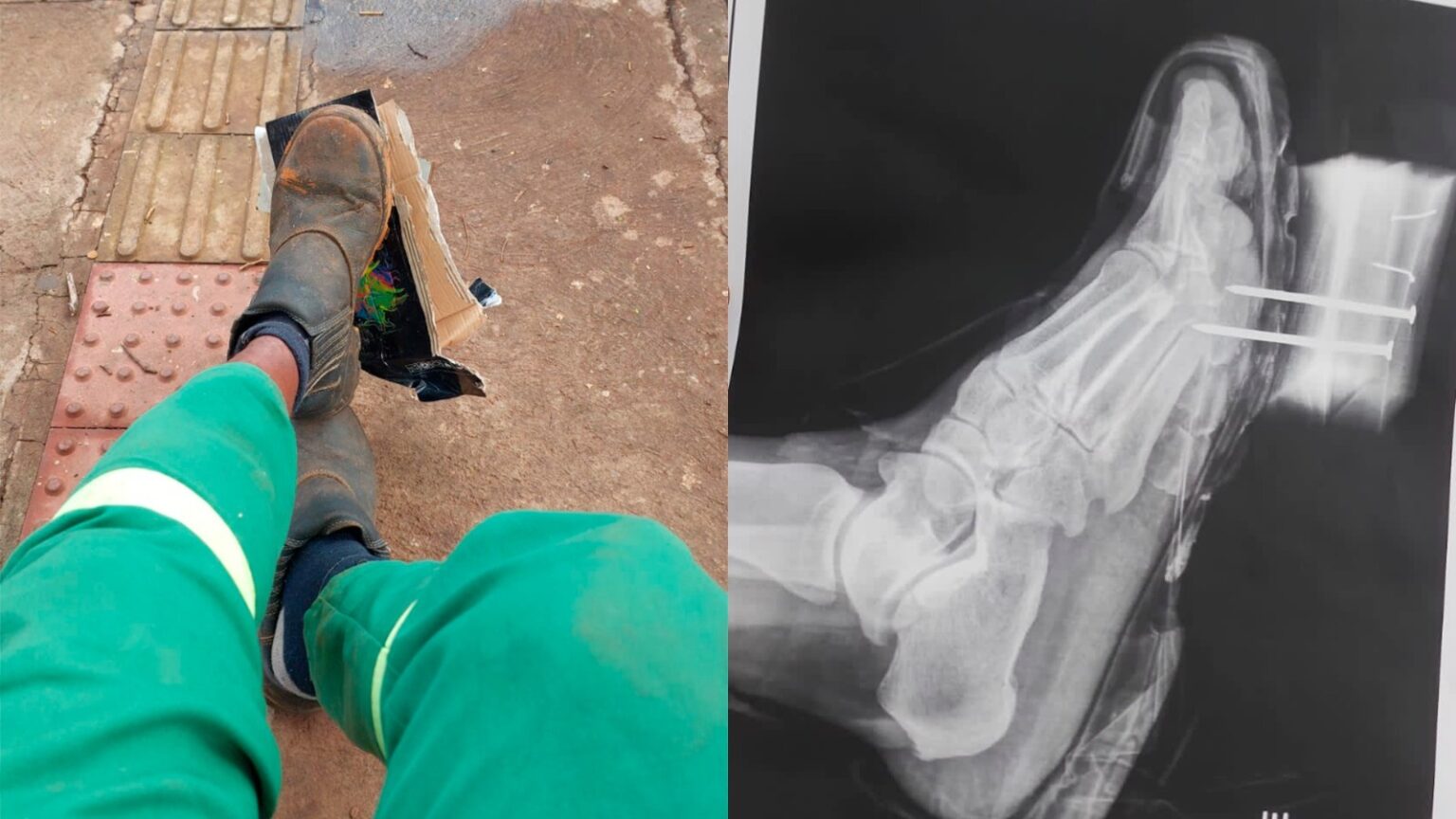 Descarte incorreto comurg prefeitura goiânia