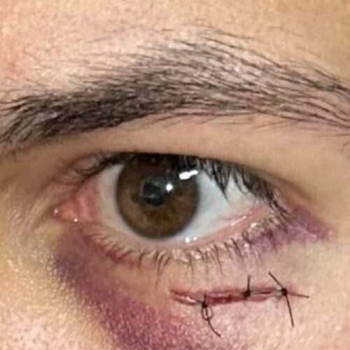 médico agredido em águas lindas de goiás