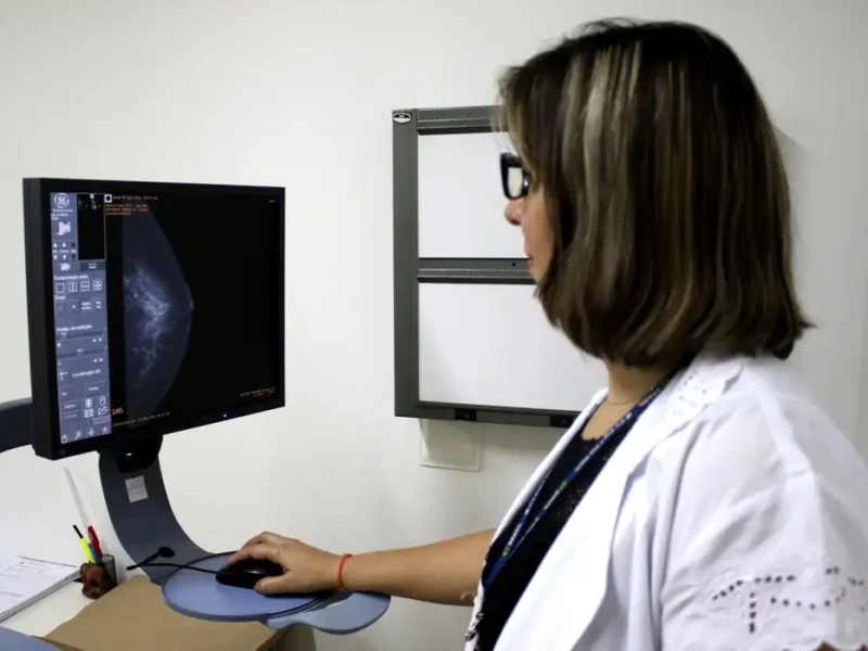 Faixa etária para mamografias foi ampliada com outras medidas pelo SUS Foto Rodrigo Nunes Ministério da Saúde