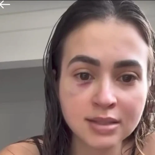 Médica Ana Paula Martins relata agressão de paciente que perdeu chamadas - Foto reprodução redes sociais