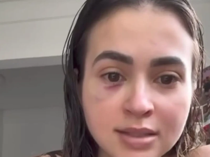 Médica Ana Paula Martins relata agressão de paciente que perdeu chamadas - Foto reprodução redes sociais