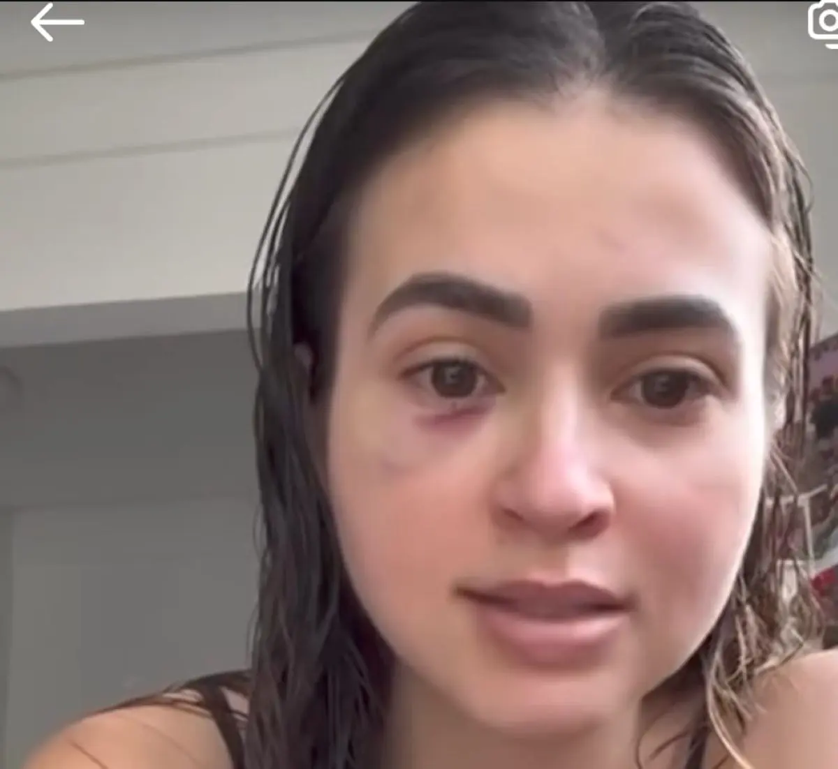 Médica Ana Paula Martins relata agressão de paciente que perdeu chamadas - Foto reprodução redes sociais