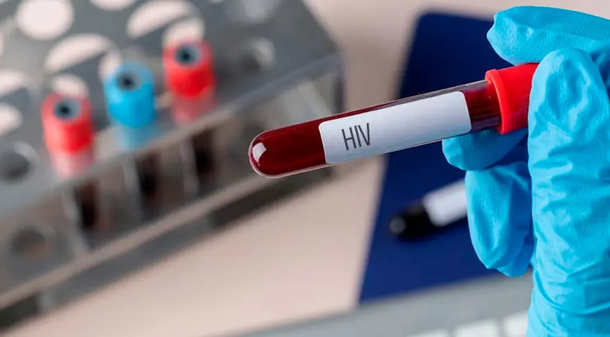 Brasil nacionaliza produção de antirretroviral contra HIV